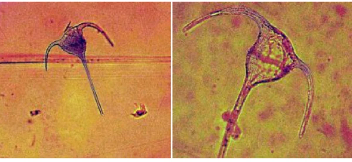 Фото: Ceratium tripos var. balticum, зафиксированный в фитопланктоне Среднего Каспия.